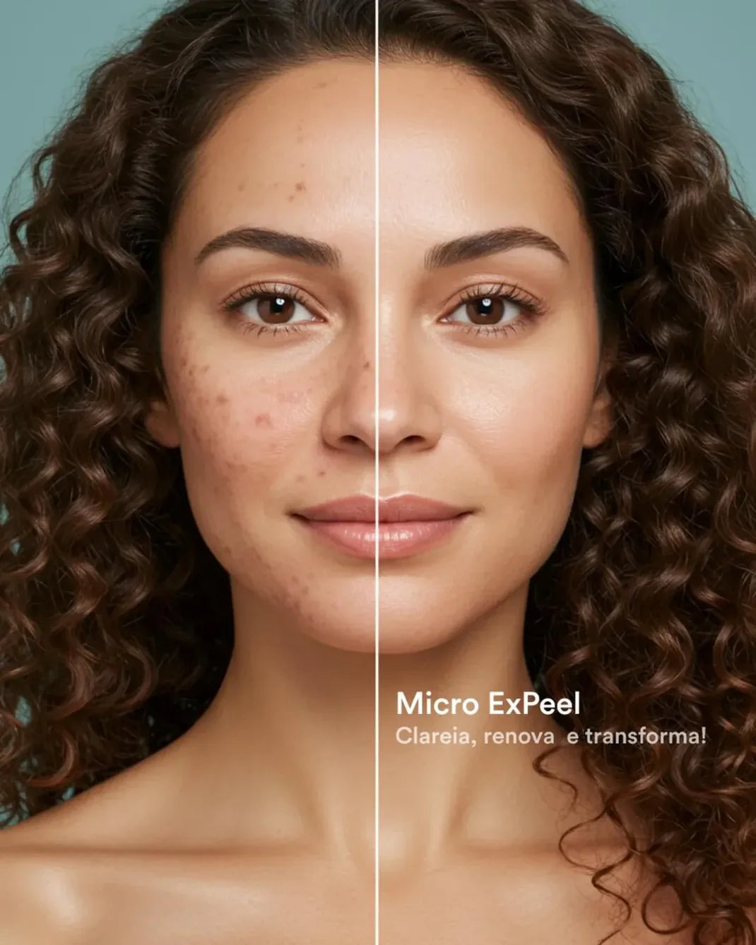 Ampola Facial Antienvelhecimento – Kit 4 Semanas com Exossomos, PDRN e Peptídeos | ExoBooster Amara