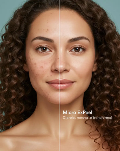 Ampola Facial Antienvelhecimento – Kit 4 Semanas com Exossomos, PDRN e Peptídeos | ExoBooster Amara